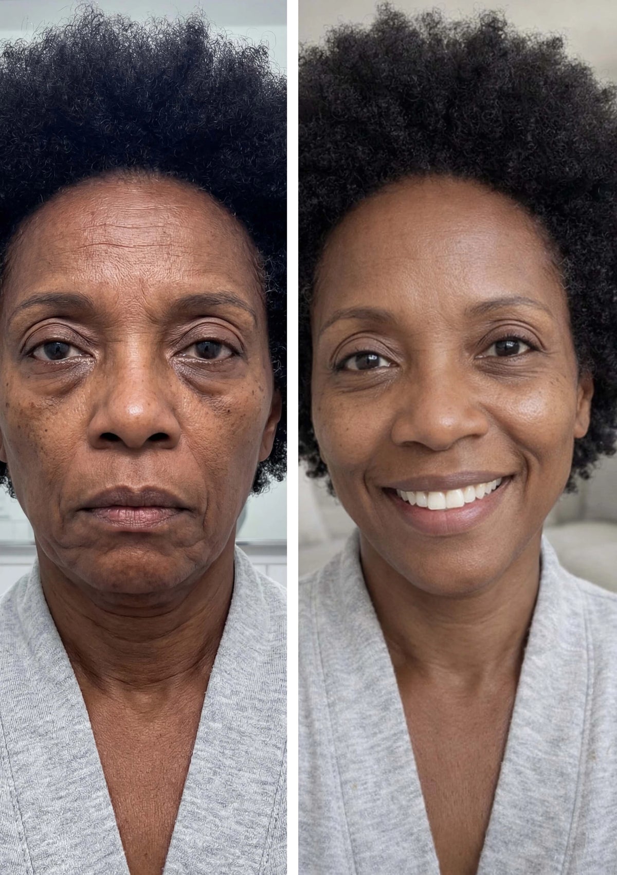Walker Skin Protect® -  Target Dark Circles, Wrinkles & Fine Lines